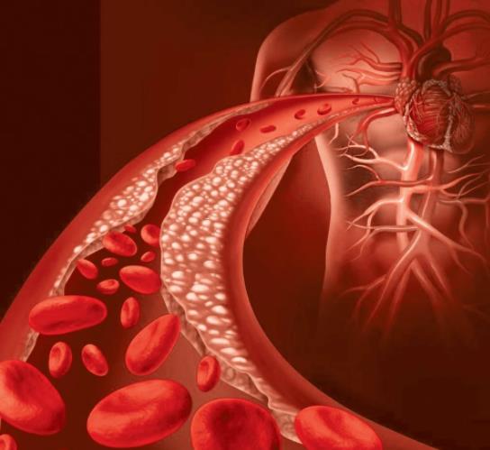 每天壓腿能減輕腳疼 特別是穿高跟鞋的女性！